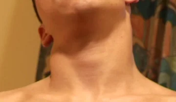 Stripping Mates