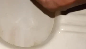 Urinating From the Penis