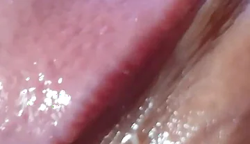 Strange Lumpy Cock with a Gigantic Head.