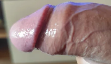 Strange Lumpy Cock with a Gigantic Head.