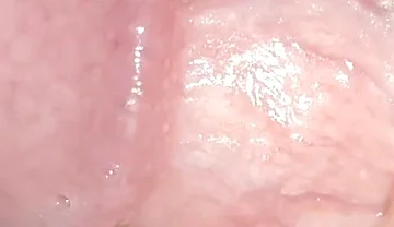 Incredible Cock, Unique of Slippery Phimosis by the Robust Body.