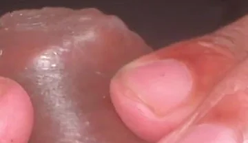 Forskin Play & My Thick Veiny Cock Shooting a Massive Creamy Load