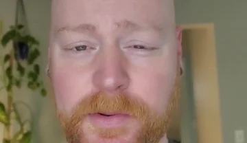 And as Always, It'll Grow Back