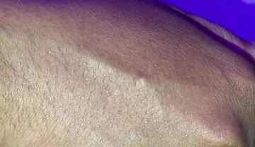 Penis Covered with a Lot of Skin