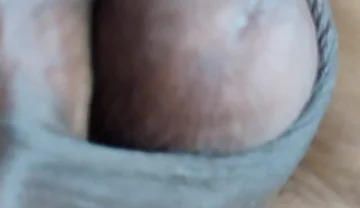 My Penis