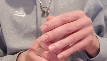 Skinny Lad Pulls Back Skin to Show Bellend