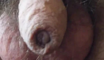 My Penis Walkabout