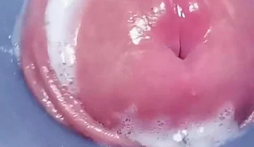 Penis Machine with a New Attachment