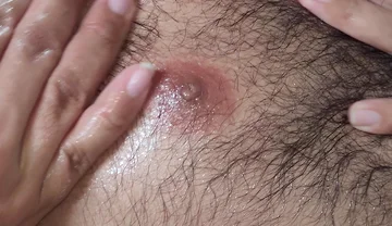 Oil on My Belly