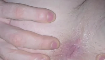 Asshole Winking