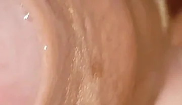 Large Cheese Accumulated in Close up of Glans