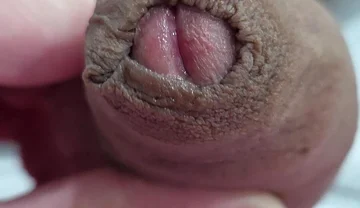 The Head of My Penis