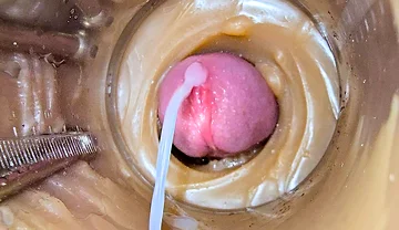 Camera Inside Deep Captures Huge Ejaculation of Sperm 2 Times