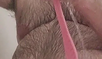 Hair Removal From a Paem or Patnf