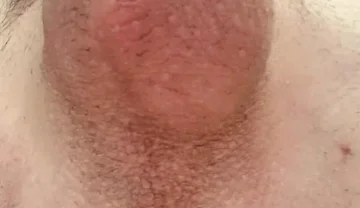 Do You Like Shaved or Hairy?