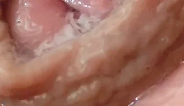 Juice From the Glans When Excited to the Extreme.