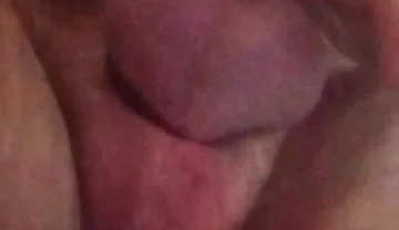 7187652