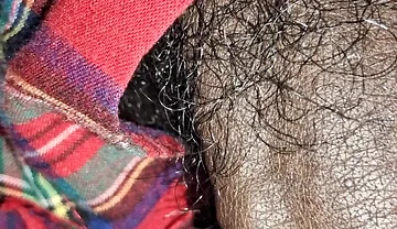 Close up on These Thick Veins