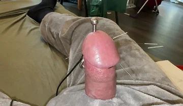 Acorn Acupuncture in a Cozy Cuddly Suit! Lots of Sperm!