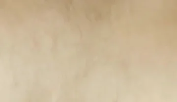 Torremolinos Meeting Bears