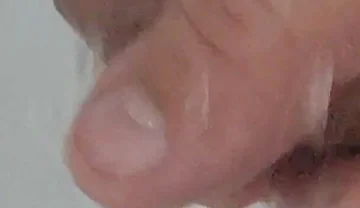 Strong Water in the Foreskin Excites the Glans Precum.