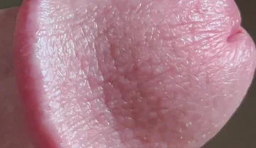 Closeup of Penis with One Vein