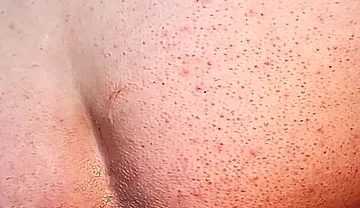 Surprising Anal Scene