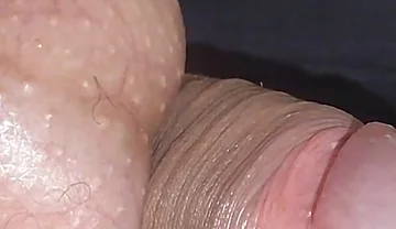Amazing Upright Rough Venous Frenulum.