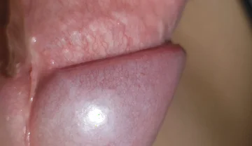 Amazing Upright Rough Venous Frenulum