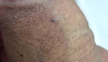What Is That on My Penis