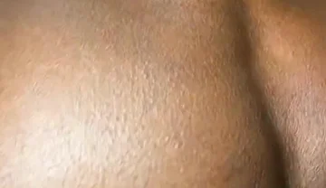 Twinks