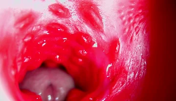 Juicy Beautiful Pussy Squelches Inside Asmr Close-up Inside the Anus
