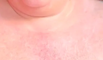 Old Man with Thickest Mushroom Penis