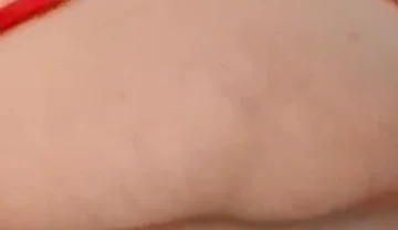 Fghffhcd