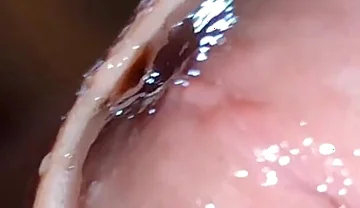 Glans Eye Watering After Intense Fucking.