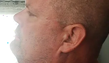 Renewed Destruction of the Bitch