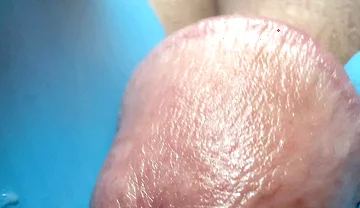 Hole Is Drilled Through