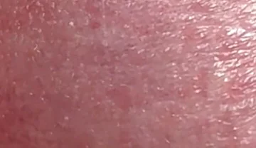 Sperm Close-up Front