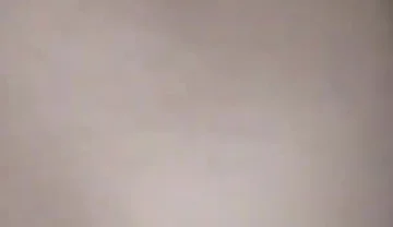 Destroying the Asshole on the Dick