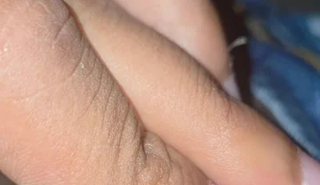 Closeup