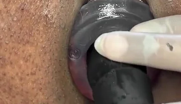 Ass Gape