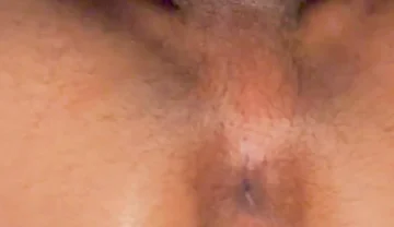 Asshole