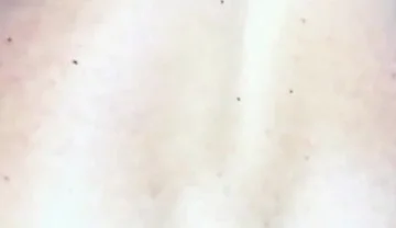 Extreme Anus Gape