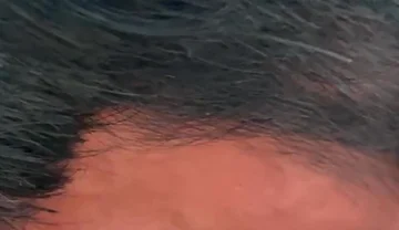 Then Sniffs First, Then Swallows
