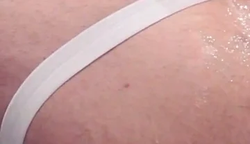 Fisting