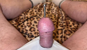 Acupuncture Is Healthy!