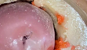The Camera 4K Inside the Deep Pussy Records a Huge Ejaculation with a Stuck Condom