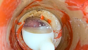 The Camera 4K Inside the Deep Pussy Records a Huge Ejaculation with a Stuck Condom