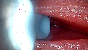 I Couldn’t Believe What Happens Inside the Penis as Sperm Passes Through (endoscopic Footage)