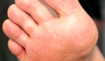 Golden Foot Bath for Pigs